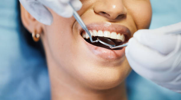 Best Broken or Cracked Tooth Emergency Dentist in Salisbury, MO